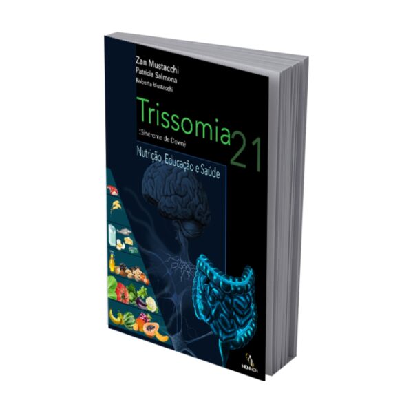 Trissomia 21 (Síndrome de Down)